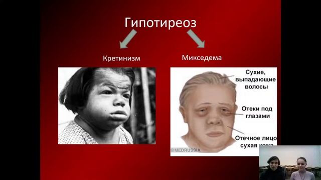 8К Биология. «Дыхание. Органы дыхательной системы» смотреть онлайн