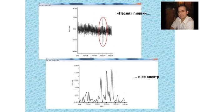 Гирудотерапия. Вебинар Альберта Ивановича Крашенюка смотреть онлайн