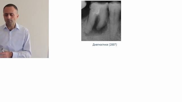 Артак Антанян Периодонтиты Базовые понятия для практики Введение Часть 1 смотреть онлайн