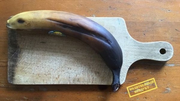 69. Обморожение третьей степени