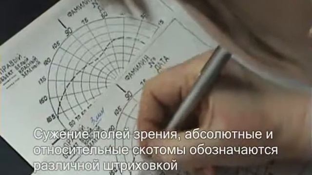 Переметрия глаза смотреть онлайн