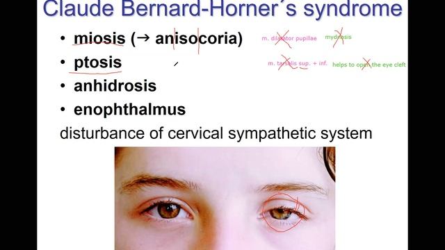 Lecture PNS 1- Autonomic Nervous system 27.3.2020 смотреть онлайн
