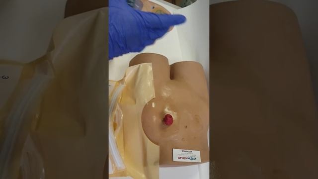 Гигиенические пакеты для стомированных пациентов при замене калоприемников и уроприемников. смотреть онлайн