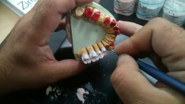 Зуботехническая лаборатория Сакура и керамическая масса Baot смотреть онлайн