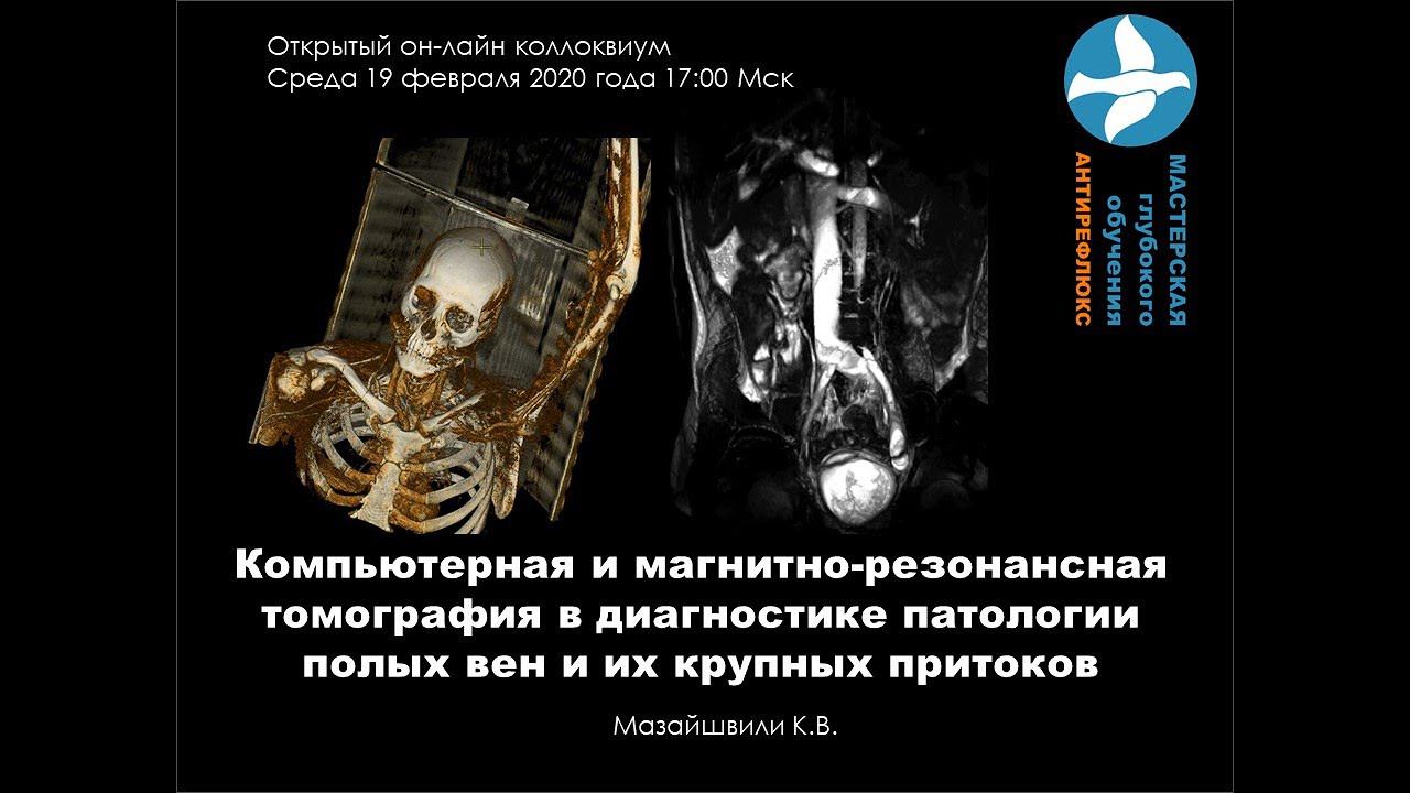 Онлайн коллоквиум КТ и МРТ вен смотреть онлайн