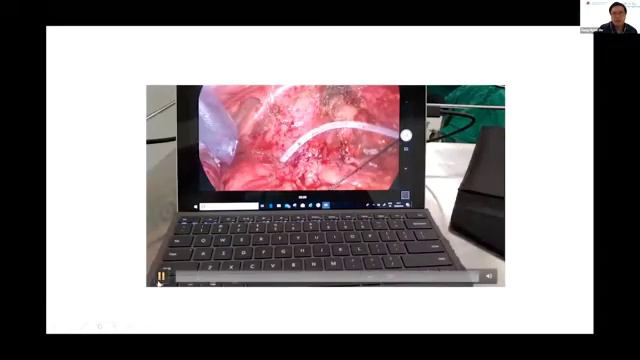 ELSA and Surgical Education смотреть онлайн