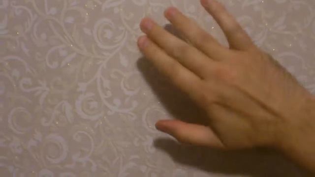 Dupuytren's contracture , Контрактура Дюпюитрена 2 часть. смотреть онлайн