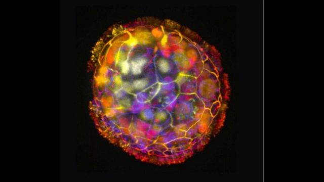Anthrobots - Tiny robots made from human cells heal damaged tissue смотреть онлайн