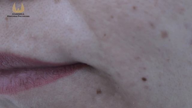 Проект "Преображение" 1 серия.Первичная консультация. смотреть онлайн