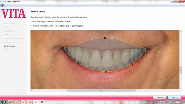 Vita Tooth Configurator Programme смотреть онлайн
