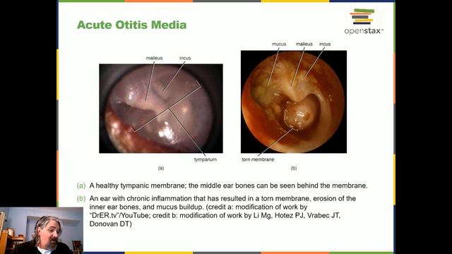 Lecture 4/15 Chapter 22 Respiratory System Infections смотреть онлайн