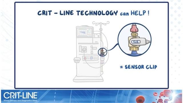 Understanding Crit-Line® Technology смотреть онлайн