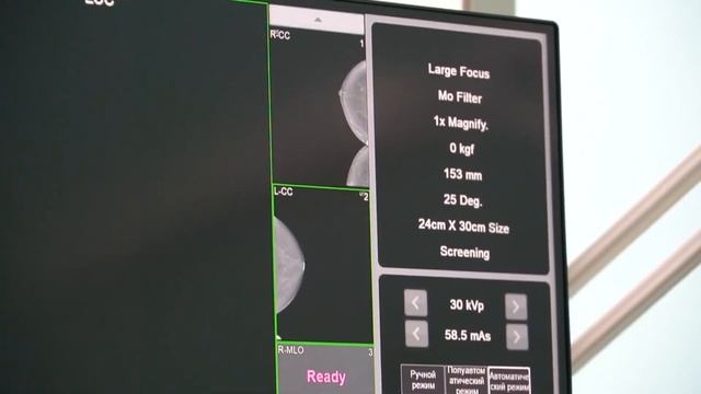 Медтайм | Массовая диспансеризация населения смотреть онлайн