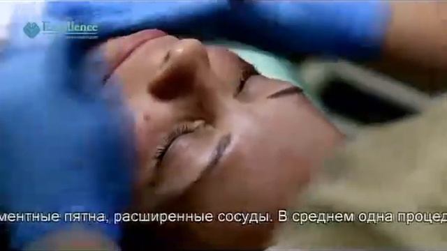 PRX-T33 - инновационный пилинг смотреть онлайн