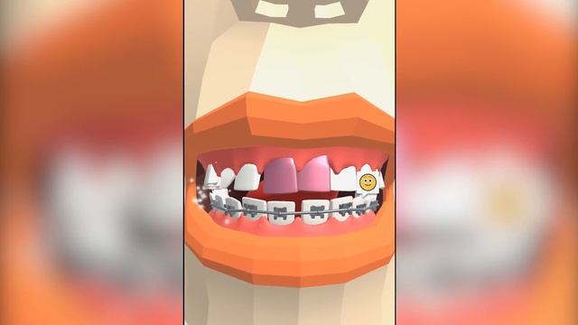 СТОМАТОЛОГ Кид лечит зубы. Делаю пломбы, вставляю новые коронки и скобы в треш игре на крутилкины смотреть онлайн