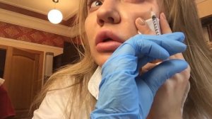 Техника "мезоботокса"