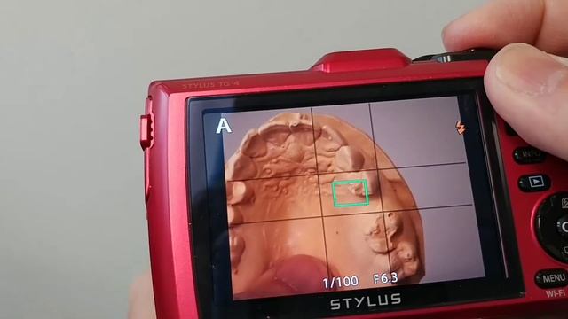 Olympus TG-4 Dental Photography Review смотреть онлайн