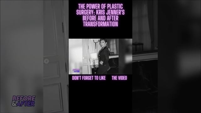 Kris Jenner | Before and After Transformations | Plastic Surgery Rumours #shorts смотреть онлайн