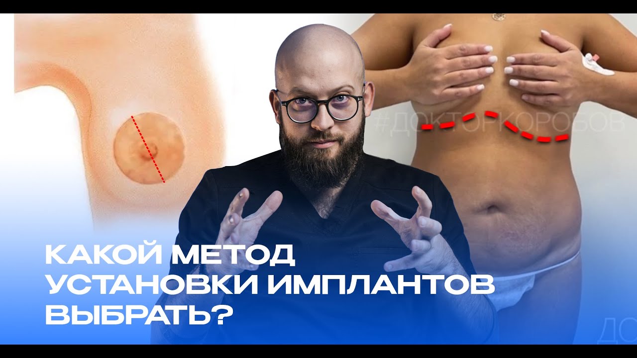 Как выбрать метод установки грудных имплантов, чтобы шрамы были незаметными смотреть онлайн