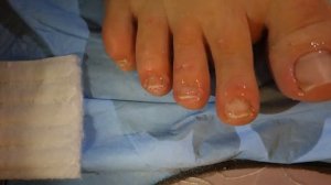 Педикюр сама себе  + Салфеточное наращивание ногтя полигелем