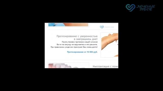 Нейлоновый протез, нейлоновые зубные микропротезы изготовление, цена смотреть онлайн