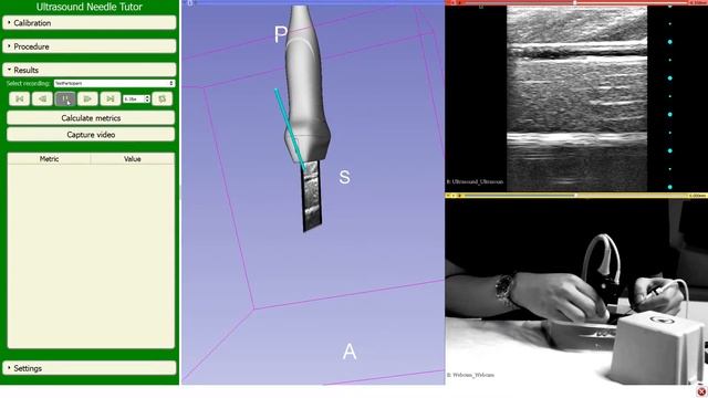 Ultrasound Needle Tutor смотреть онлайн