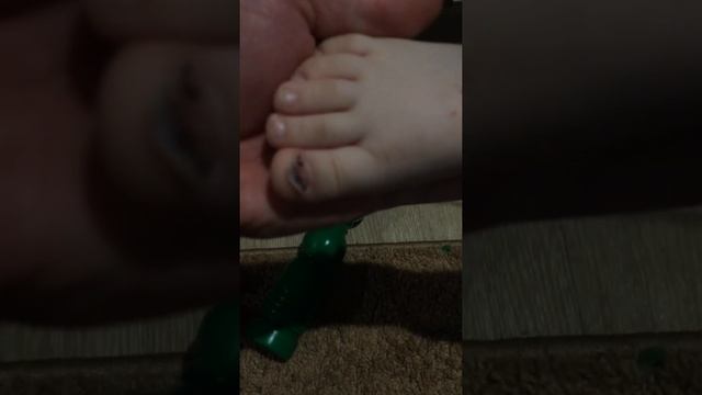 Смешно))))Отпал ноготь смотреть онлайн