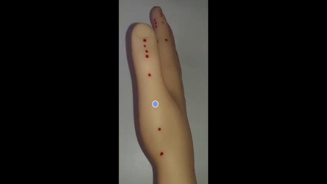 Су-Джок терапия. Базисные точки. Новая версия. смотреть онлайн