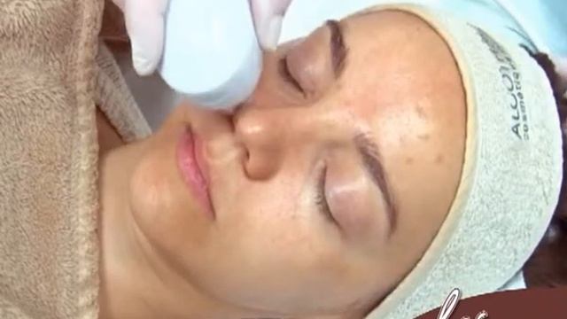 Криолифтинг