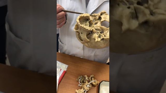 ЦНС. Черепные нервы смотреть онлайн