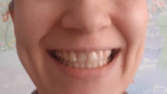 Упражнение лягушка. Артикуляционная гимнастика. Занятие с логопедом. смотреть онлайн