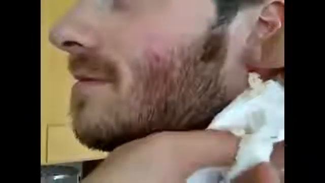 Ear Cyst Surgery смотреть онлайн