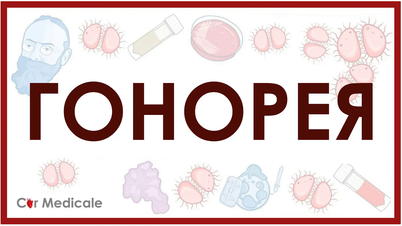 Гонорея - возбудитель (Neisseria gonorrhoeae), симптомы смотреть онлайн