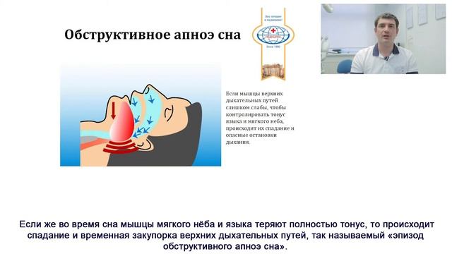 Стоматологическое лечение храпа и синдрома апноэ сна смотреть онлайн