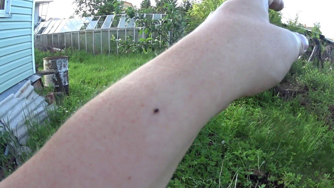 Клещ Ищет Место Где Присосаться смотреть онлайн