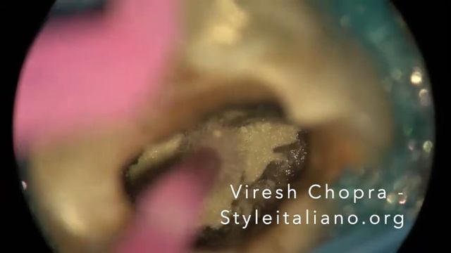 Chopra - Microbrush use смотреть онлайн