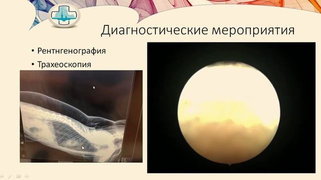 Торакальная хирургия. Основные и часто встречаемые патологии смотреть онлайн