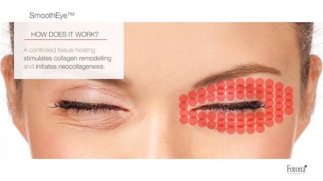 SmoothEye™ смотреть онлайн