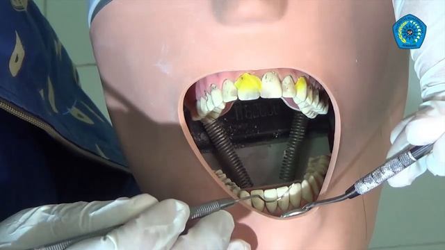Pemeriksaan Oral Hygiene Index Simplified смотреть онлайн