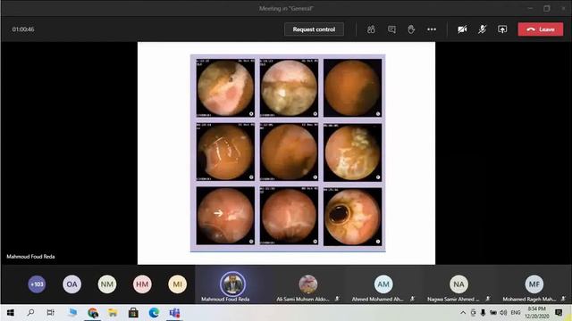 IBD AND INTESTINAL ISCHEMIA смотреть онлайн
