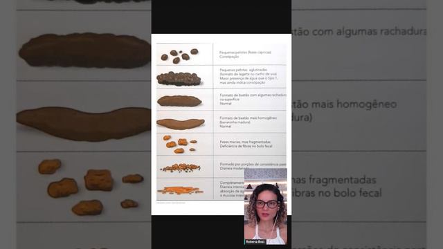 O que o seu cocô tem a ver com candidíase? смотреть онлайн