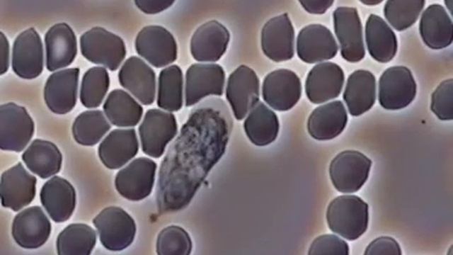 Live Blood Analysis - WBC смотреть онлайн