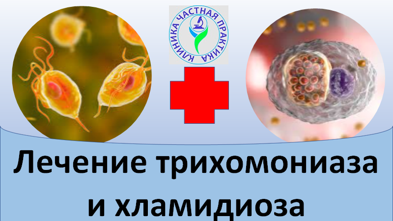 Лечение трихомониаза и хламидиоза смотреть онлайн