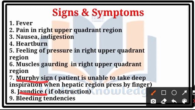 Cholecystitis Notes || Explain in hindi || Cause, signs & symptoms, diagnosis & management смотреть онлайн