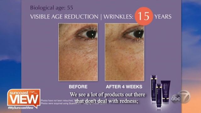 Beauty Expert Mickey Williams Talks About DefenAge on Suncoast View ABC7 | DefenAge смотреть онлайн