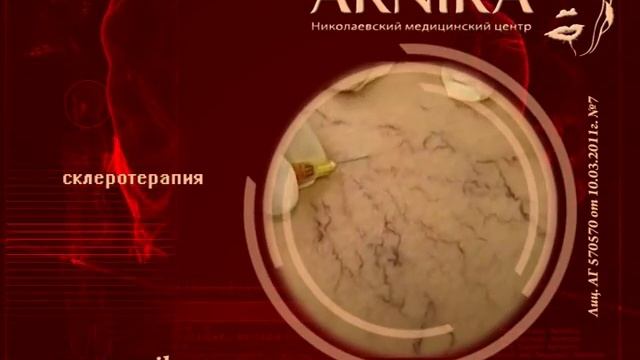 МЦ Арника - методы лечения сосудистых патологий