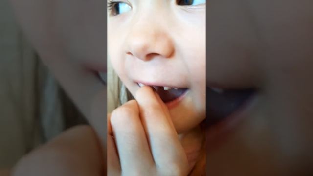 У меня шатается зуб. Скоро выпадет зуб. смотреть онлайн