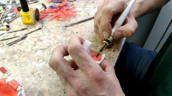 Изготовление восковых шаблонов с прикусными валиками