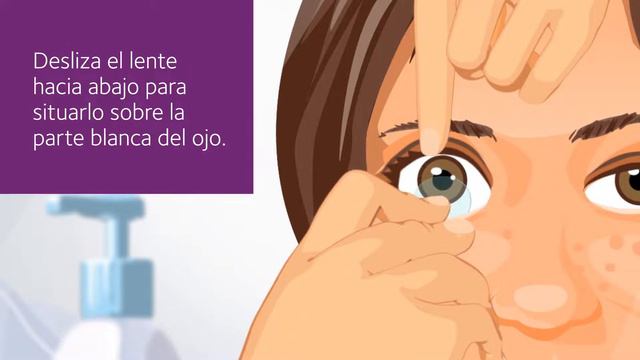 ¿Cómo Quitarse Los Lentes De Contacto MiSight  ® 1 Day ?