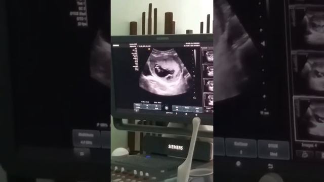 Мой младшенький, 11 недель смотреть онлайн